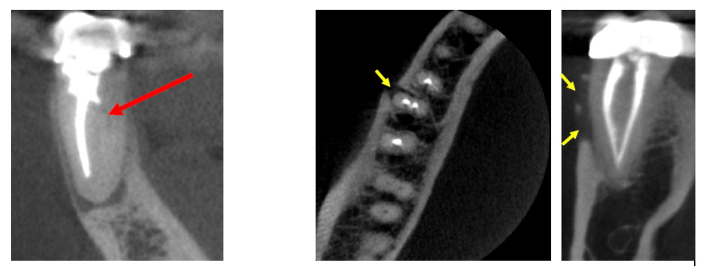 CBCT Technology in West San Angelo