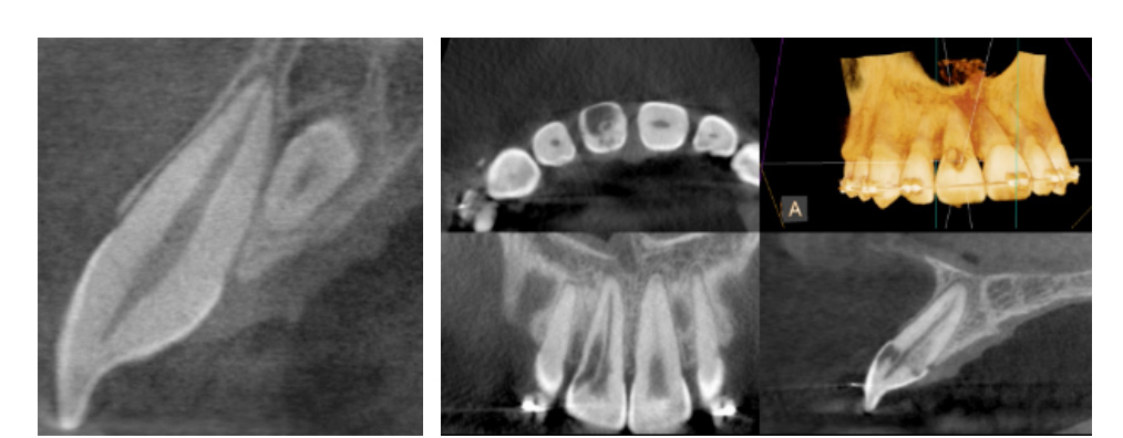 CBCT Technology in West San Angelo